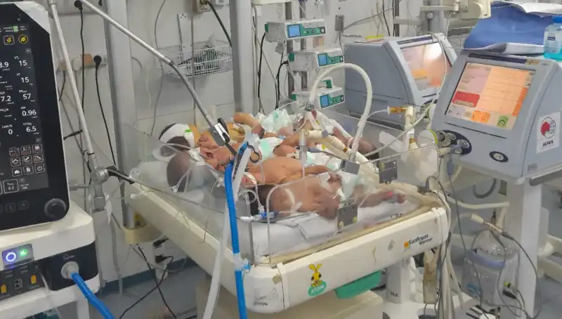 Gazzeli Doktorlar Beklenmedik Krizle Karşı Karşıya: Çocukların Hayatı Tehlikede