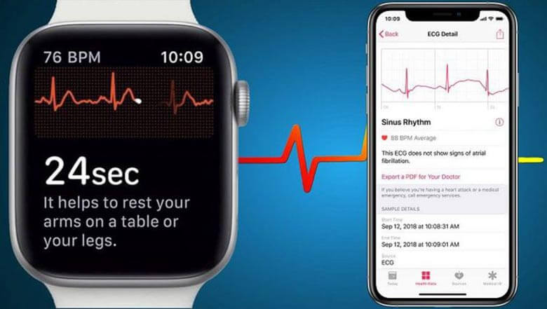 Apple Watch Döngü İzleme ve AFib Geçmişi Türkiye’de Kullanıcılara Sunuldu